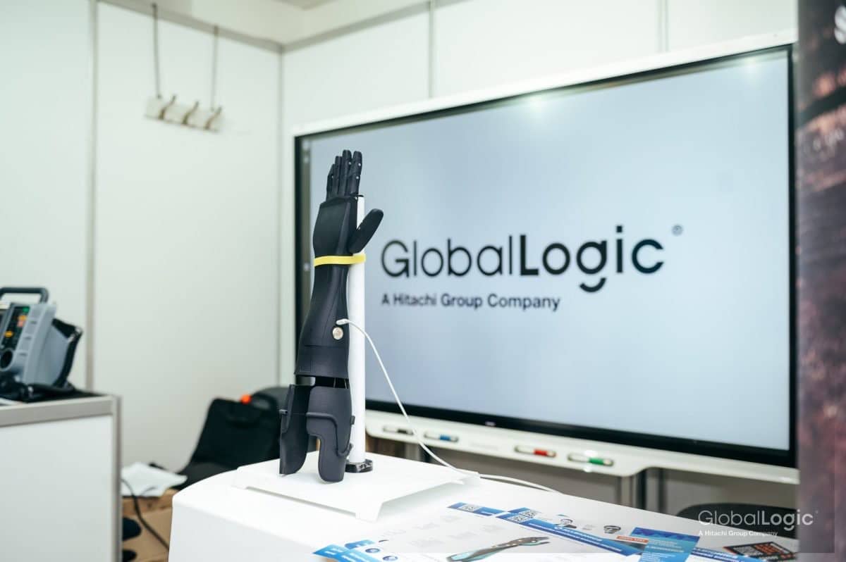 GlobalLogic розробили програмне забезпечення для біонічних протезів із використанням штучного інтелектe